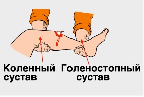 Основы первой помощи. Помочь и не навредить