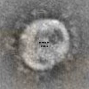 В Новосибе показали первые изображения коронавируса COVID-19 под микроскопом