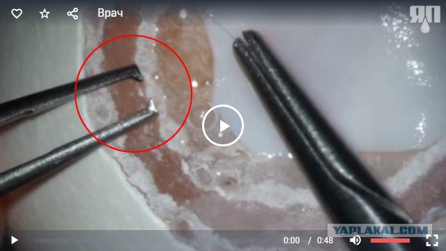 Врач демонстрирует свою хирургическую точность, пришив кусок ткани под оболочку яйца