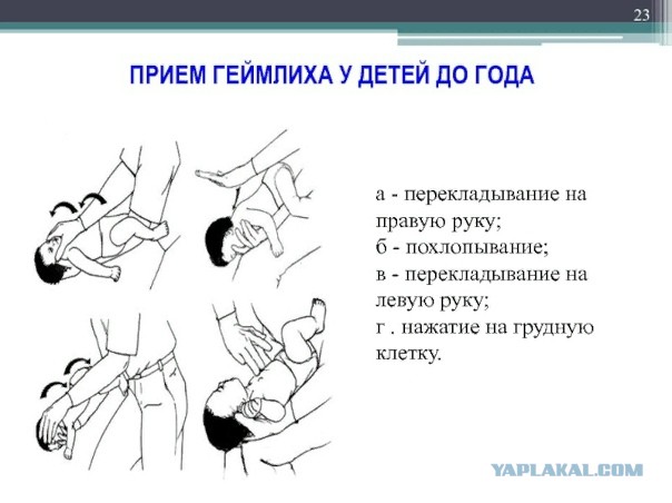 Прием Геймлиха применяли когда-либо?