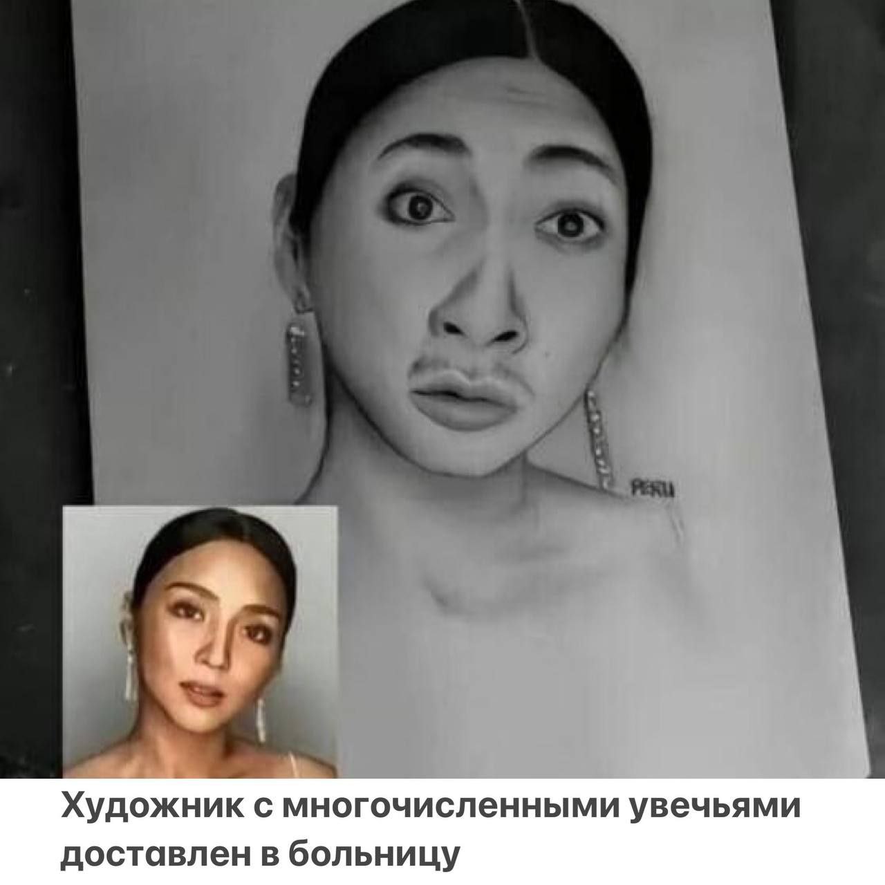 Почему художника отправили в больницу