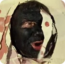 Самовозгорание пациентов в барокамере: кишечные газы