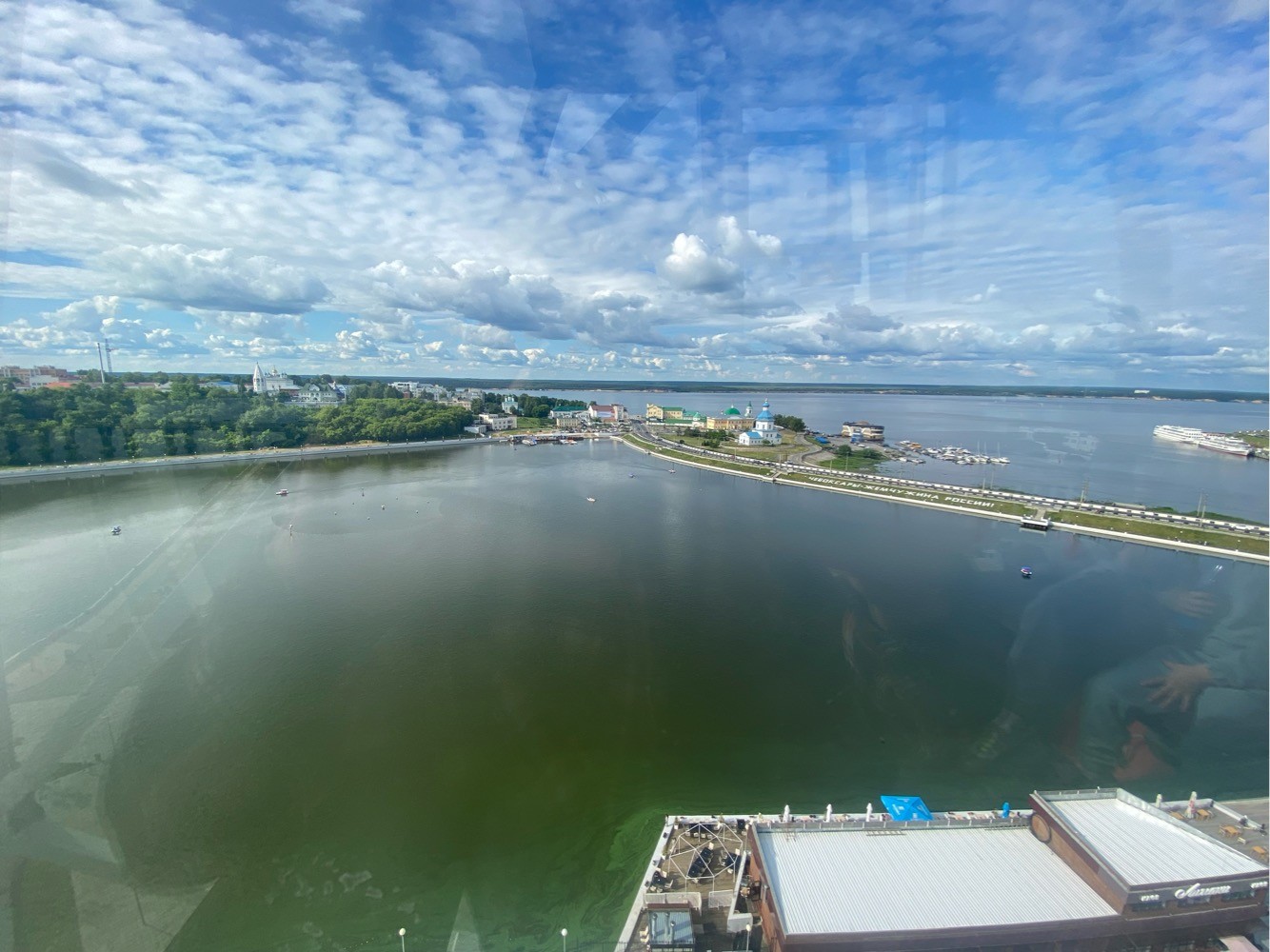 тётю иру ебут Пересадка Волос в Владикавказе Цена от 60₽ за волос с Гарантией роста по  договору