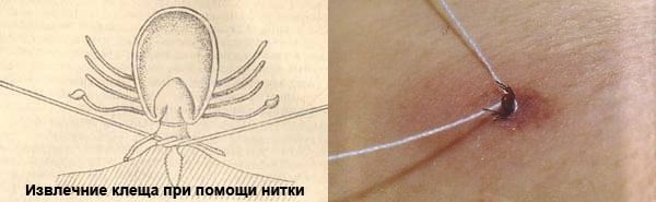 Народ России - власти: Когда вы уже нажретесь-то?