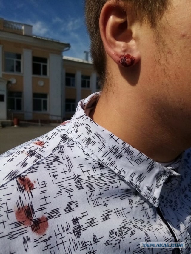 «Ходишь как пи**рас»: директор школы в Курской области порвал ухо восьмикласснику за то, что тот не хотел снимать серьгу