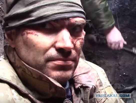 Солдаты ВСУ при отступлении бросили своего раненого товарища. ФОТО
