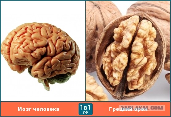 После смерти Брюса Уиллиса его мозг будет передан медикам для изучения