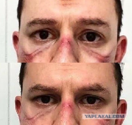 Фото итальянских врачей после смены