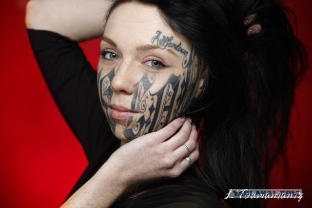 Лазерное удаление татуировки