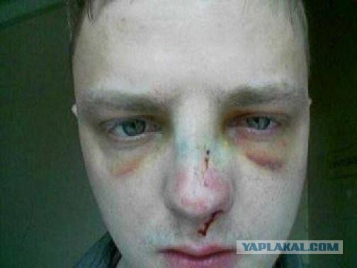 Подборка фактов об огнестреле в разных странах