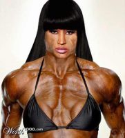 Девушка-анорексичка взялась за себя и выздоровела