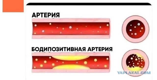 «Бодипозитив»
