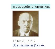 гемор