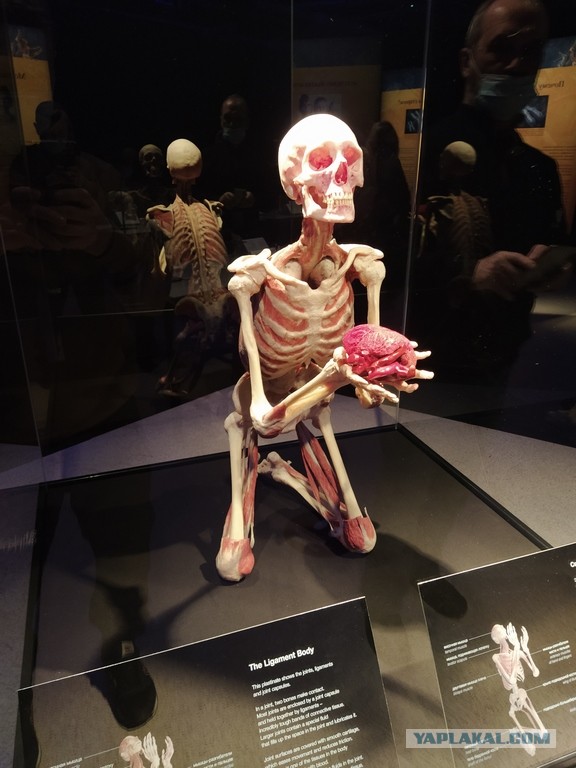 Посетил выставку Body Worlds на ВДНХ