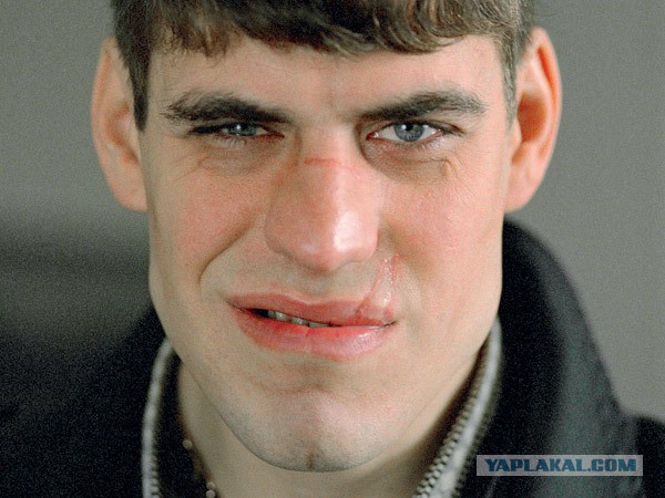 Дежавю, "Жмурки" и Саммит НАТО
