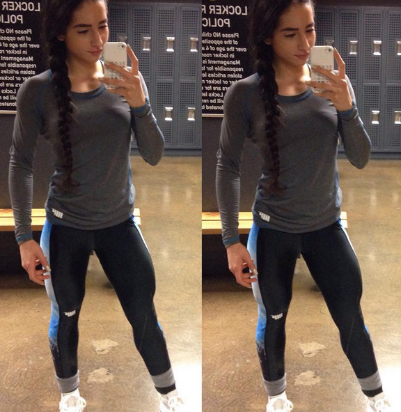 Девушка-анорексичка взялась за себя и выздоровела