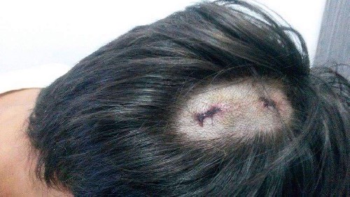 Премия Дарвина разминулась с мозгом идиота на пару миллиметров