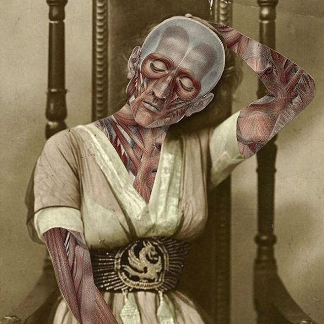 Лёгкое психическое отклонение ч7. Картинок пост 16+