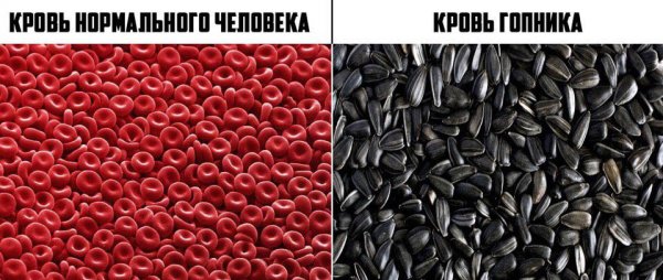 Смотрим и деградируем