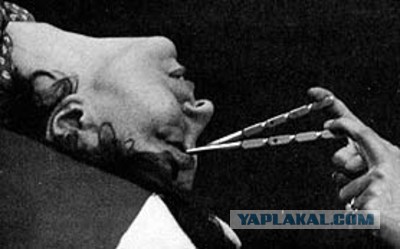 Самые ужасающие медицинские инструменты прошлого