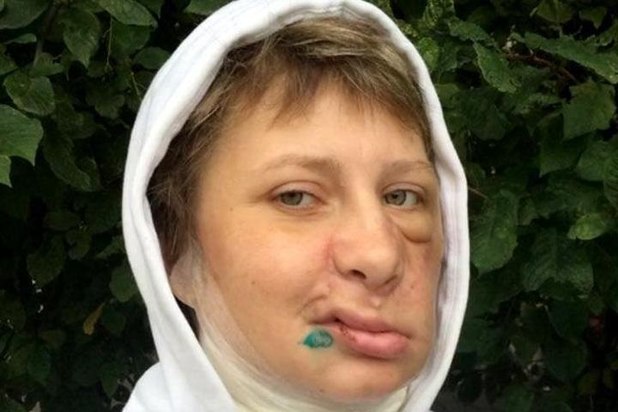 Марина и медведь: страшный рассказ выжившей в схватке со зверем.