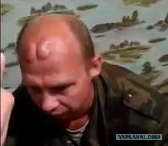 Больничный