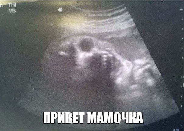 Кровь, кишки и трэшак в картинках