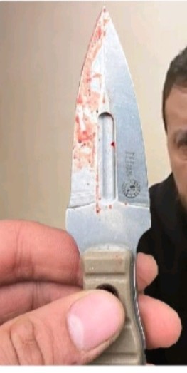 700 человек эвакуировали из больницы, где в том числе лежат пострадавшие при теракте в "Крокусе", из-за угрозы взрыва