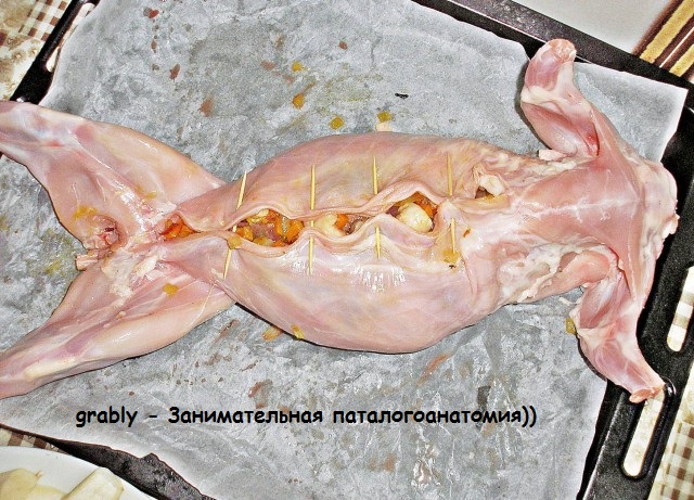 У Степана грибок. И пересадка печени.