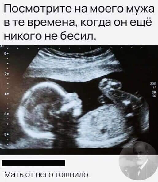 Бредзона 15.12.20