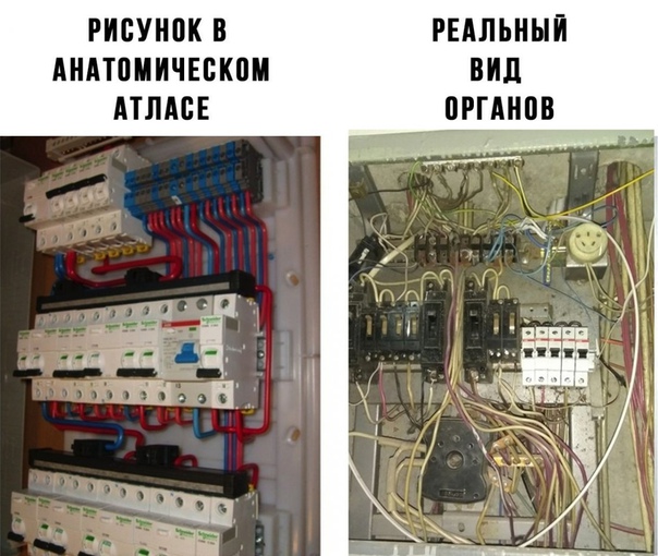 Электрожиза