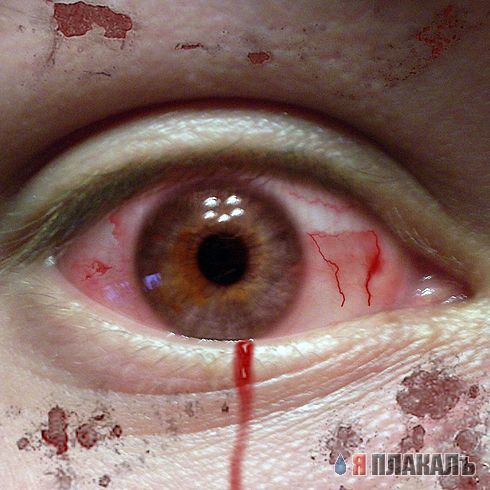 ГЛАЗА разные бывают