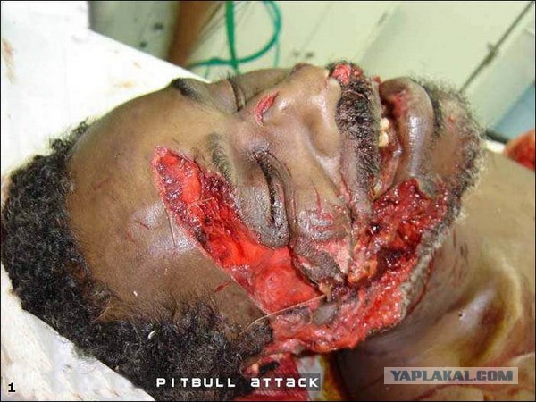 Убил питбультерьера, которого натравил хозяин