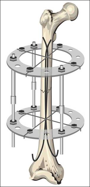 Самый отчаянный антипрививочник