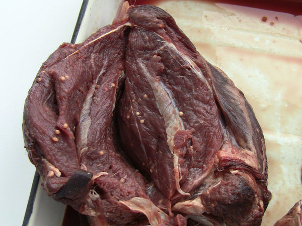 Красноярские хирурги достали из печени мужчины огромного червя