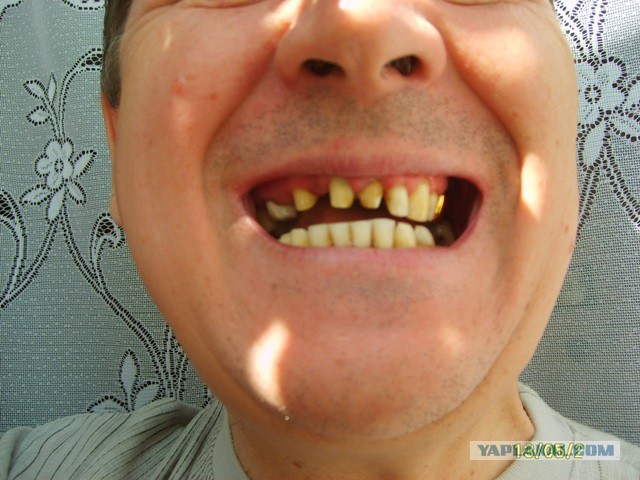 Пересчитать все зубы...
