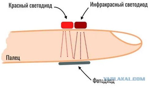 Почему в аптеках нет дешевых пульсоксиметров?