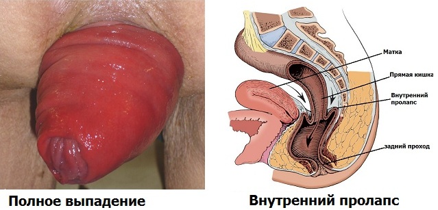 Мужскую колонию пополнит трансгендер из Аксая