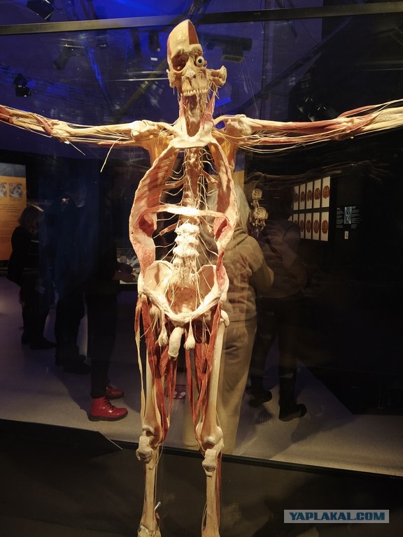 Посетил выставку Body Worlds на ВДНХ