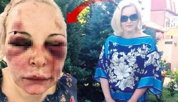 Отрежу тебе лицо: любовник два дня истязал россиянку в отеле в Турции
