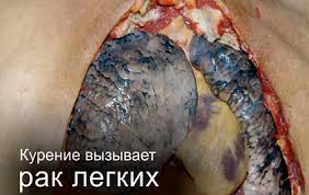 Куришь дома - плати бабки соседям