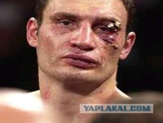 Клочко совсем сбрендил