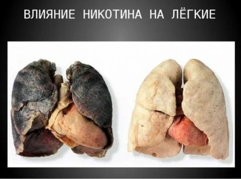 А мне пахнет! Конфликт с соседями
