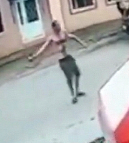 В Запорожской области в результате взрыва гранаты мужчине оторвало руку