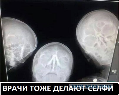 Селфи медиков