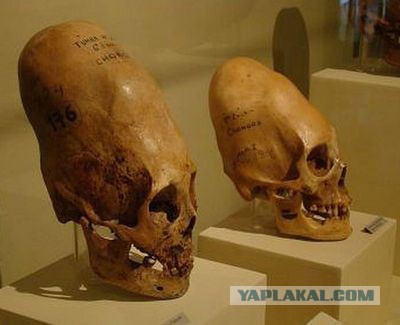 Удлиненные черепа принадлежат пришельцам.