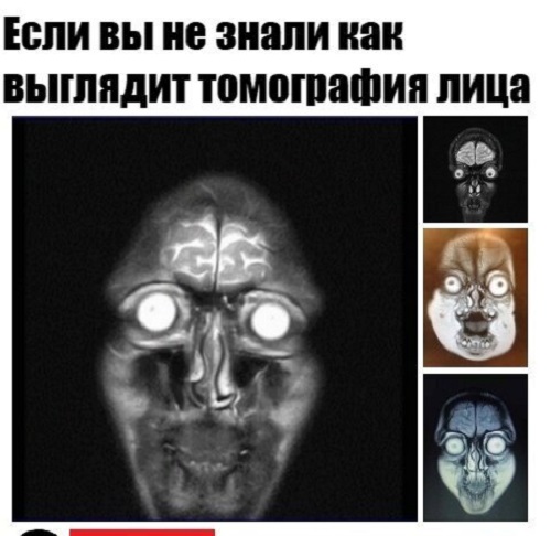 Бредзона 24.12.20