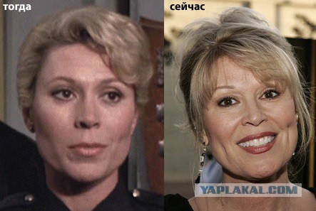 Знаменитости, которые безобразно стареют