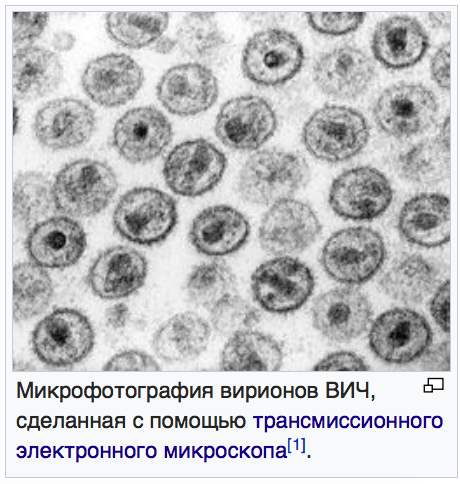 Все больше людей ударяются в мракобесие и отрицают существование ВИЧ