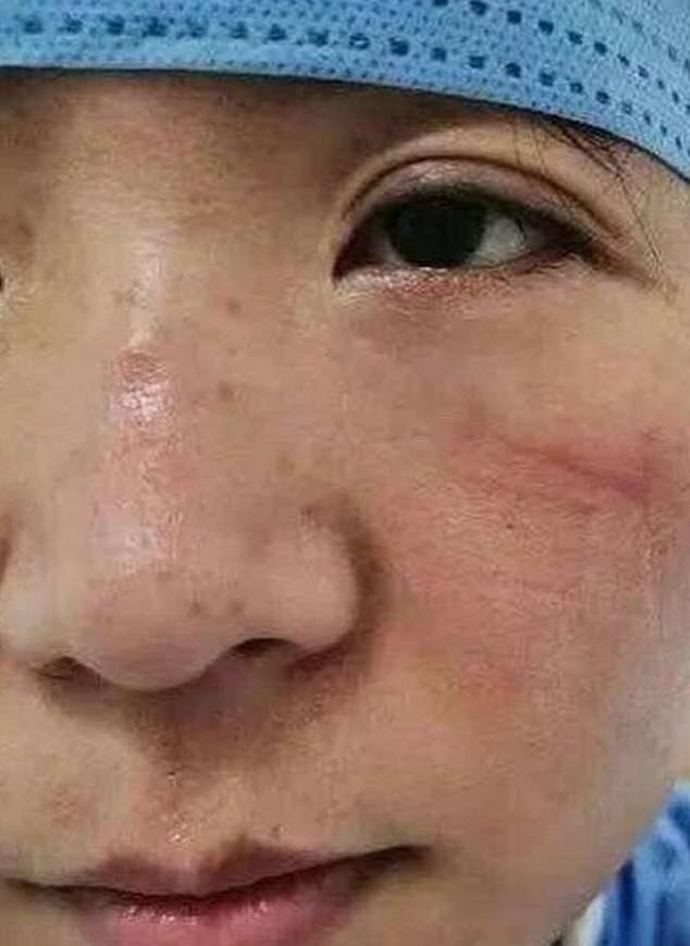 На переднем крае борьбы с коронавирусом: лица врачей, отработавших 8-10-часовые смены в респираторных масках